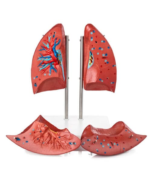 مجسم الرئة (4 أجزاء)