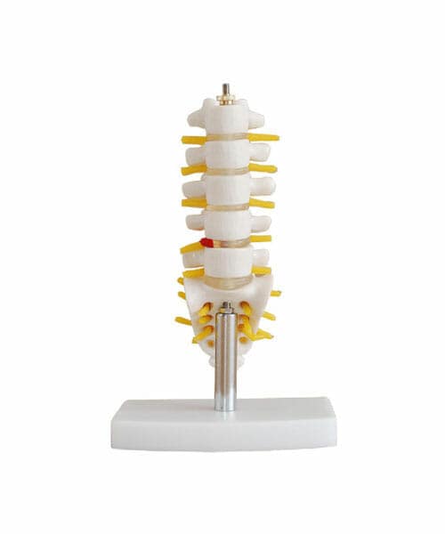 Mini Lumbar Vertebrae with Sacrum & Coccyx and Herniated Disc XC-119A